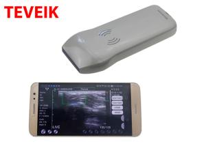 Wholesale Portable Wireless Ultrasound Probe Medical Ultrasonic Convex Probe Doppler Scanner from china suppliers