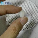 0.3mm Thin Glass Ceramic Veneer Implants Lightweight Veneer Cases
