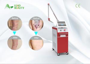 Wholesale Vertical 1064nm 532nm Q-Switched ND YAG New Laser tattoo removal machine from china suppliers