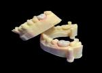 Biocompatible Dental Zirconia Crown For Single / Multiple Teeth High Strength