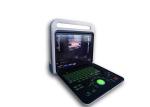 4 D 15 Inch LED Diagnostic Color Doppler Ultrasound Scanner With 2 Probe