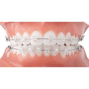 Wholesale Easy Clean Orthodontic Ceramic Bracket Beautiful Fixed Orthodontic Appliances from china suppliers