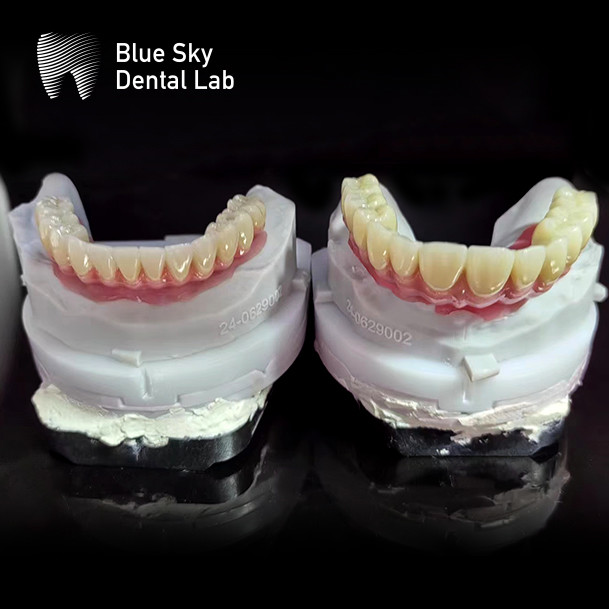 Customized Full Arch Implant Cases Universal Implant Operation Cases