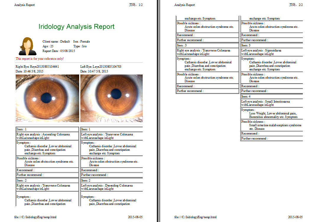 Left And Right Lamp Iriscope Iridology Camera Analyzer English Spanish Chinese Language
