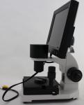 Professional Microcirculation Microscope / Nailfold Capillary Microscopy with
