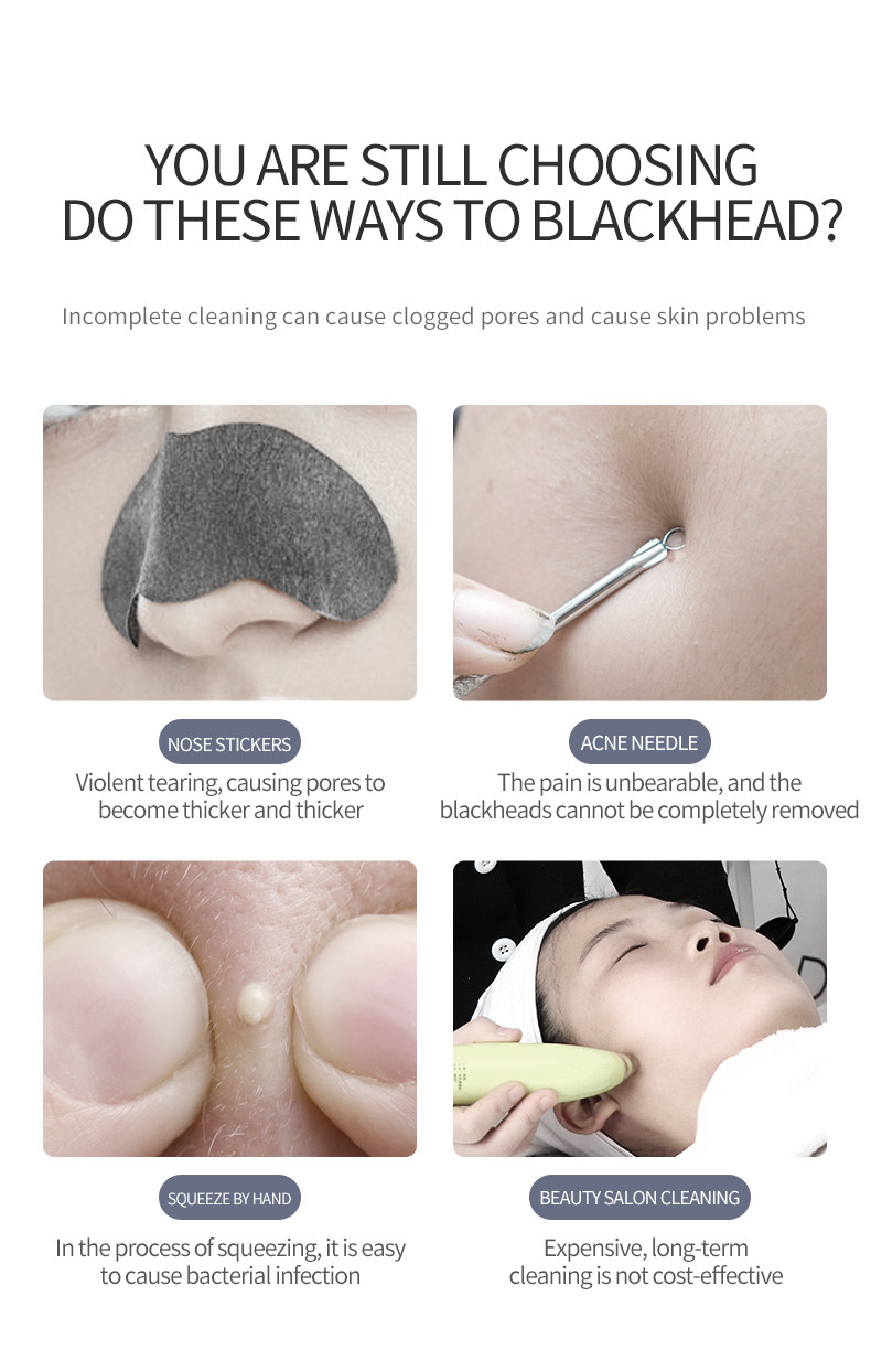 400mAh Portable Ultrasonic Skin Scrubber , Pore Vacuum Blackhead Remover