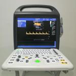 Best Price Portable Veterinary Ultrasound Scanner 2D/Doppler For Small & Large
