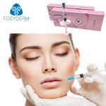 Transparent 1ml Sexy Lips Hyaluronic Acid Derm Line Gel Dermal Lip Fillers
