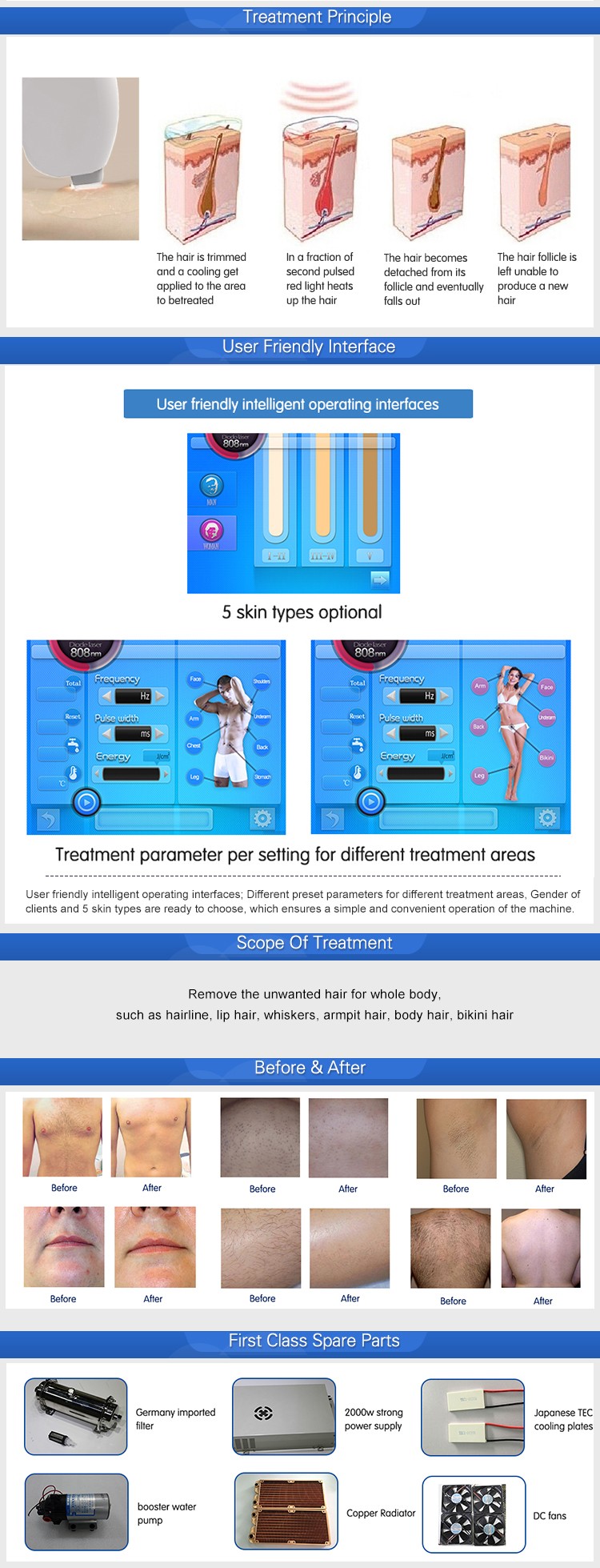 2017 HOT sale!!! 808nmdiode laser hair removal machine