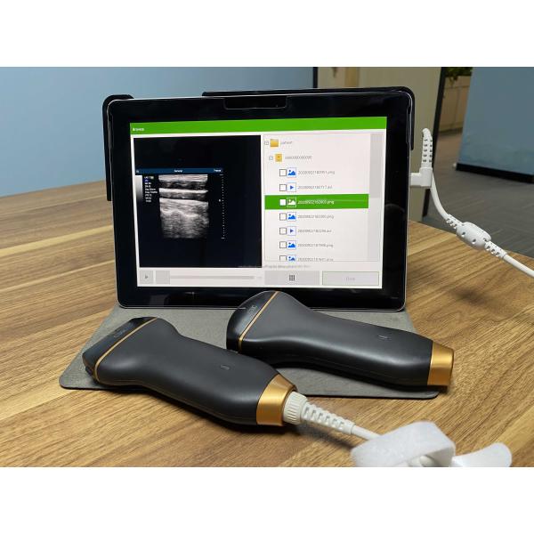 Mobile Smart USB Color Doppler Ultrasound Probe For Laptop