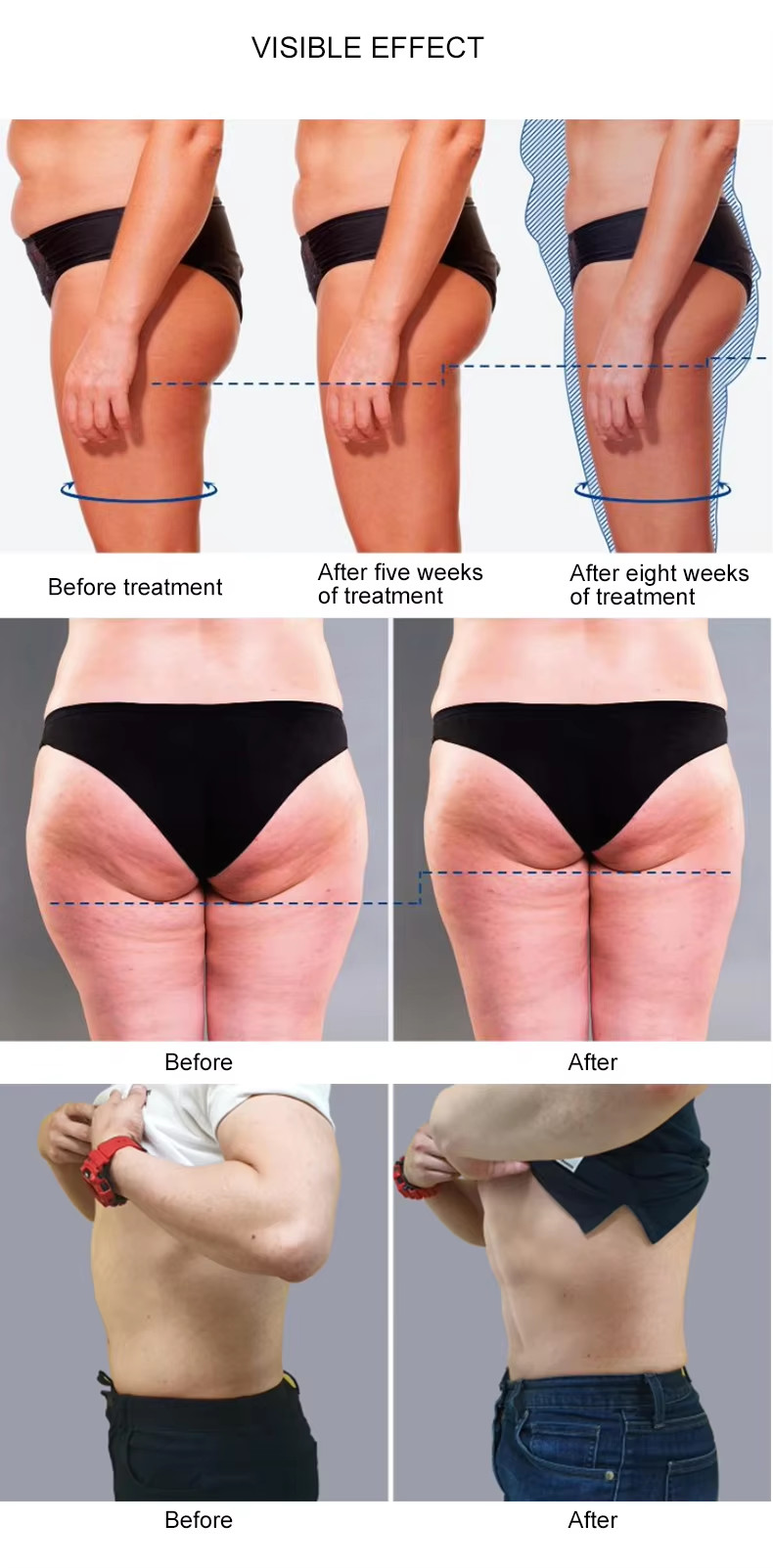 Portable EMS Slimming Muscle Stimulator