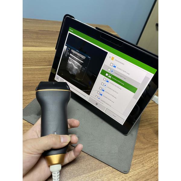 Mobile Smart USB Color Doppler Ultrasound Probe For Laptop