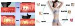 Painless Permanent Hair Removal Diode Laser Hair Removal Machine for beauty