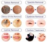 Portable 755nm Picolaser Tatoo Remover Q Switch Nd Yag Picosecond Laser Tattoo
