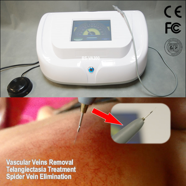 High Frequency Vascular / Spider Vein Removal Machine , Laser Varicose Vein Treatment
