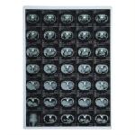 210 Microns X Ray Film Medical Inkjet Laser For CT Dr Mr