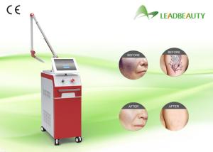 Wholesale Painless 1320nm 1064 nm 532nm gentle long pulse pigments tattoo removal from china suppliers