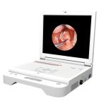 Gynecology ENT Portable Endoscope Camera 17" Mobile