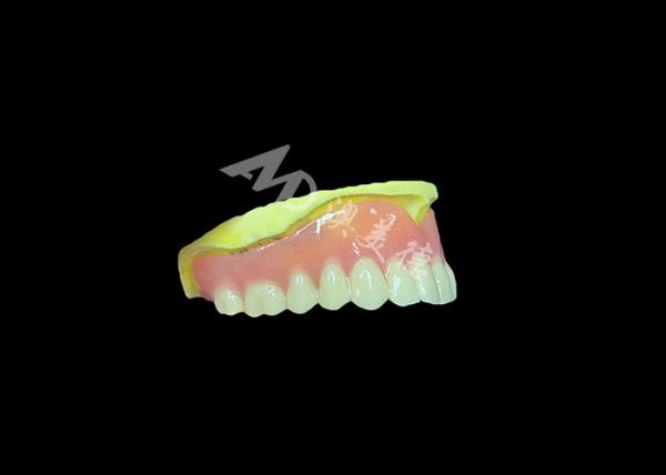 Cast Partial Dentures Crafted for Durability Comfort and Aesthetic and Lasts
