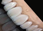 Translucency Stain Resistant Ceramic Crown Bridge Precise Fit for Natural