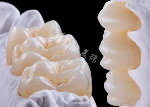 Wholesale High Strength Zirconia Dental Crown For Single Or Multiple Teeth Replacement from china suppliers
