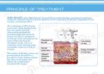 5-8cm Fat Removal After 1 Month !!! Hifu For Body Shaping