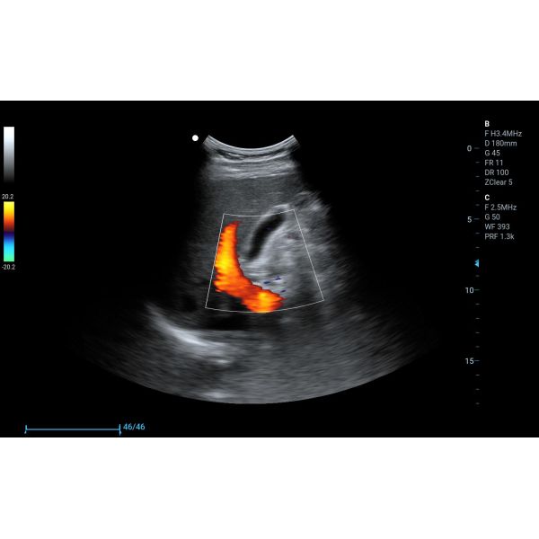 Best Price CW, TDI , PDI Handheld Portable Ultrasonido 3D 4D Veterinary Doppler Ultrasound Machine