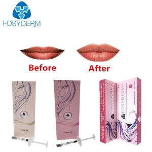 Wholesale Wrinkles And Lips Hyaluronic Acid Injectable Filler With Lidocaine from china suppliers