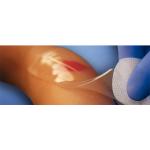 High Quality Medical Sheet Would Hydrogel Dressing with Best Price