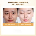 OEM ODM 6X Retinol Moisture Soothing Whitening Anti Wrinkle Anti Aging Facial