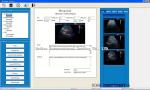 two probe holders Portable 2D Color doppler ltrasound Scanner human ultrasound