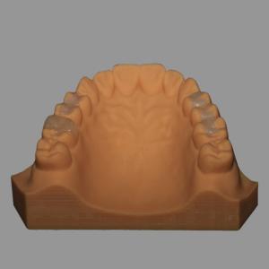 Wholesale Full Ceramic Dental Emax Inlay Onlay Crown Pressed / Milled from china suppliers