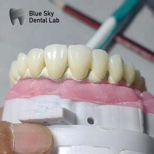 Wholesale Universal Dental Implant Case Compatible With Multiple Implant Systems from china suppliers