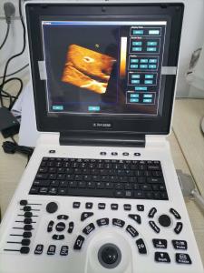 Wholesale Xianfeng Pregnancy Color Doppler Ultrasound Machines Images 4B OEM from china suppliers