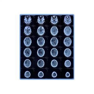 Wholesale Blue Medical X Ray Film For Inkjet Printers With High Sharpness And Low Fog from china suppliers