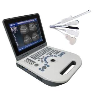 Wholesale TGC Control Notebook Ultrasound Scanner For Pregnancy Home Use from china suppliers