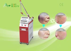 Wholesale Q-switch nd yag laser tattoo removal machine with professional technology from china suppliers
