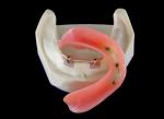 High Biological Inter Miscibility Denture Dental Lab Safety Implant