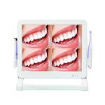 High Pixel Dental Intra Oral Camera Machine 1 Or 4 Screen Dental Intraoral