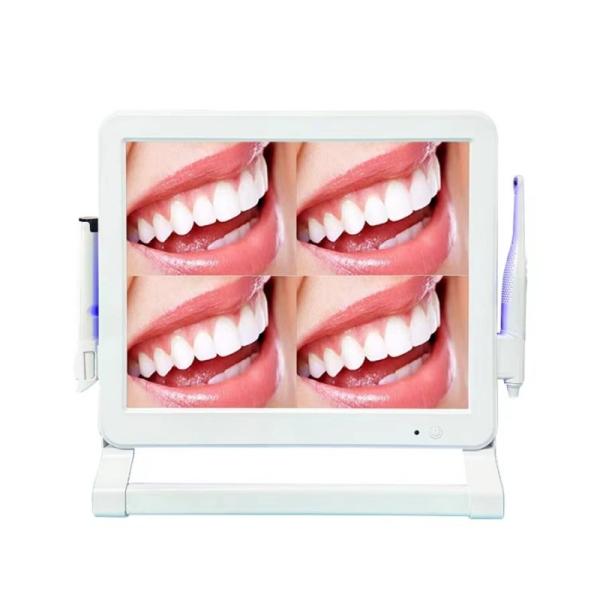 High Pixel Dental Intra Oral Camera Machine 1 Or 4 Screen Dental Intraoral