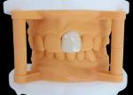 Translucency Zirconia Dental Crown with Aesthetic Performance from China Dental