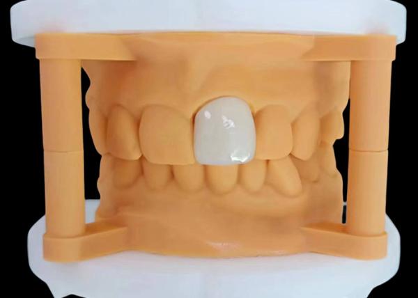 Translucency Zirconia Dental Crown with Aesthetic Performance from China Dental