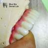 Buy cheap Nature Surface Universal Compatible Multiple Choices Implant operation cases for from wholesalers