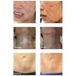 Women Body Art Animated Eyebrow Tattoo Removal Pen Machine 12000rpm