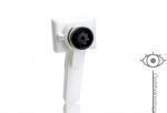 3 Lens Available Ophthalmic Equipment Digital Fundus Camera Eye Surface Camera