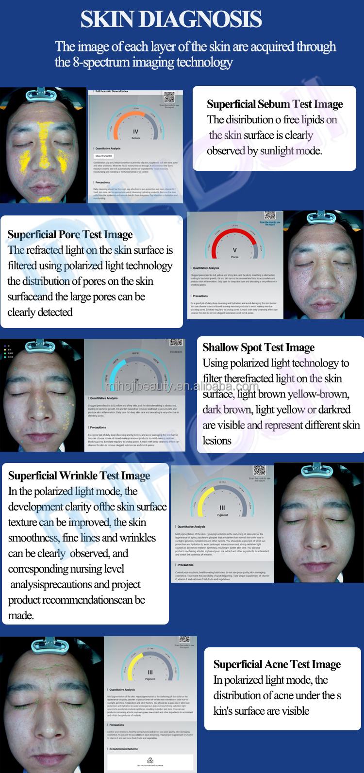 12 Million Pixels Camera Facial Analyzer with Touch Screen ' AI Skin Analysis of Full Face