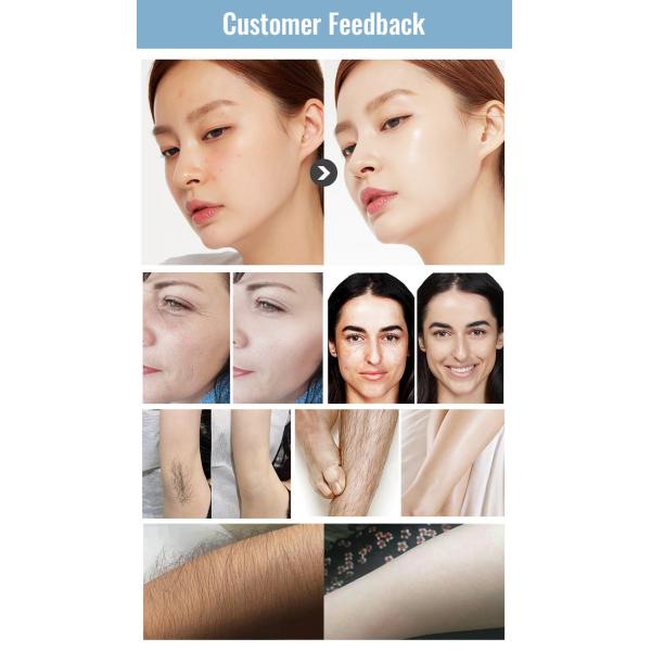 10 Bars 808nm Soprano Ice Laser Machine Skin Rejuvenation And Freckle Removal