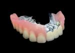 Enhance Your Smile Natural-looking PFM Crown bridge and Removable Dentures Combo