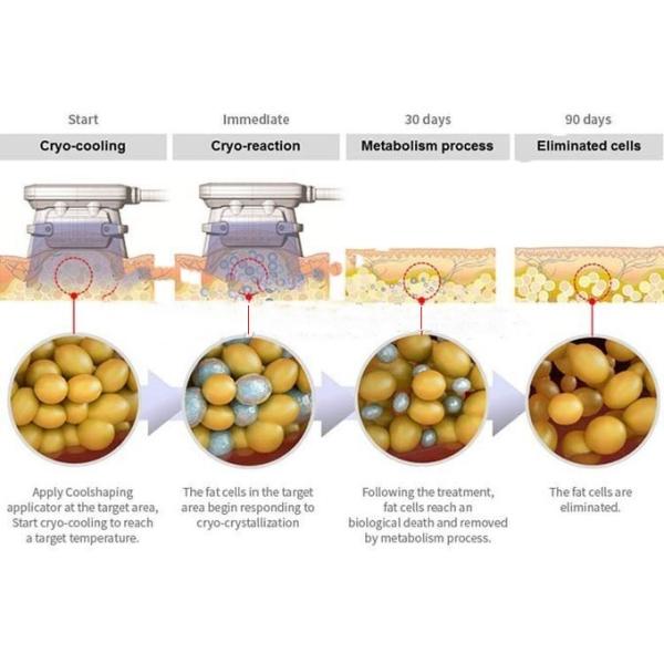 Most Effective! Cellulite Removal Machine , Cryogenic Lipolysis Machine No Pain