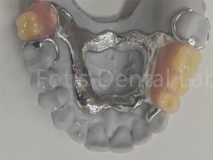 Wholesale FDA Easy To Clean Removable Partial Denture Compatible With Natural Teeth from china suppliers